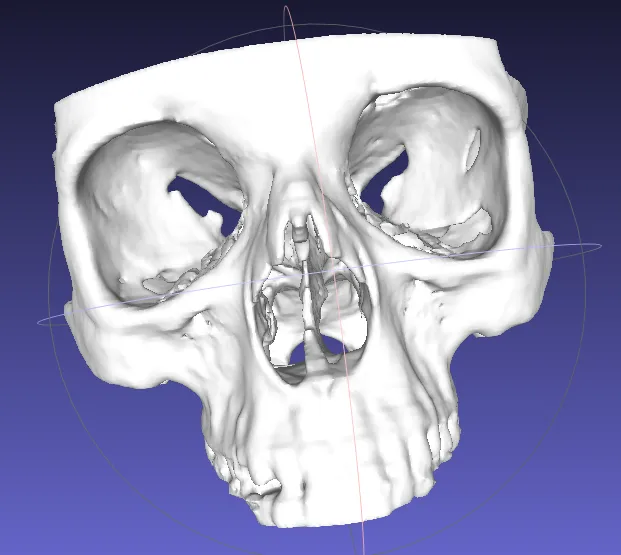 Medical Scans