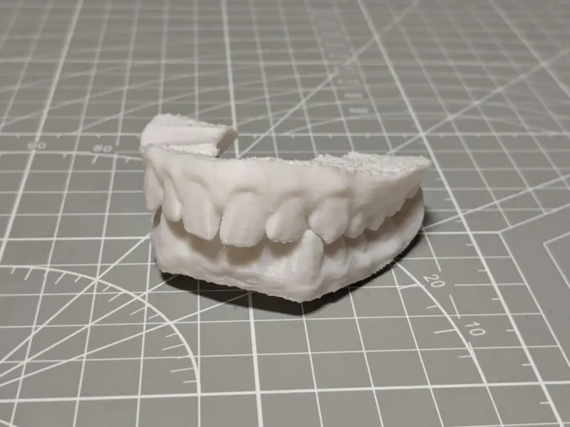 A real 3d scan of my teeth