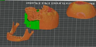Skull with detachable top and mandible
