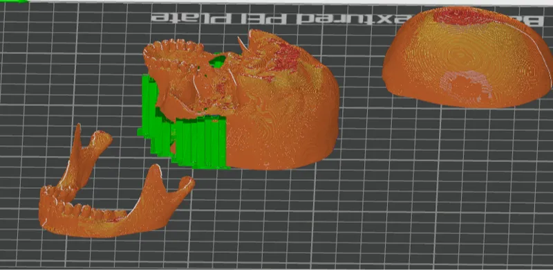 Skull with detachable top and mandible