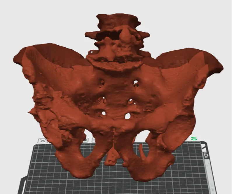 骨盆 pelvis