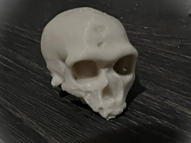 Damaged Cro-Magnon Skull