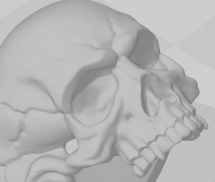 Skull-Ring Remix