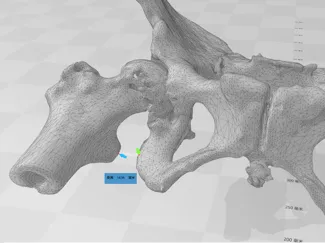 骨盆
