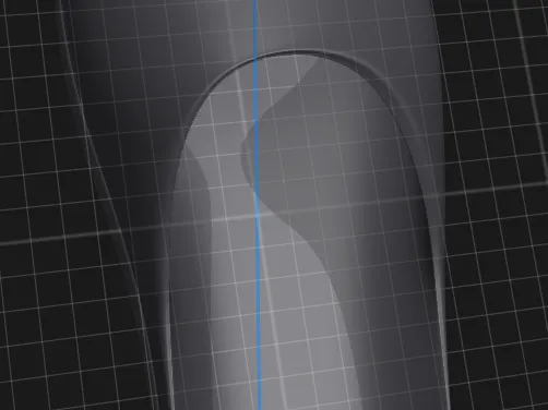 Shoe