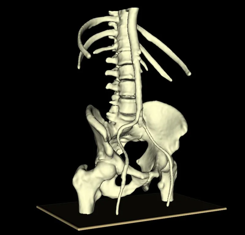 Pelvic-Abdominal Vascular Model (PAVM)