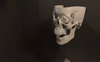 Ben Engel CT scan exprt