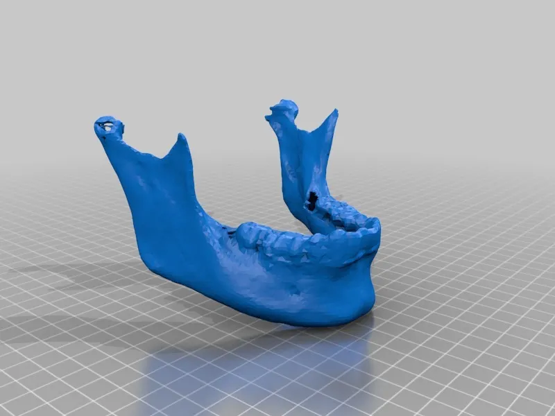 Ben Engel CT scan exprt by Ben Engel - MakerWorld