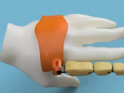 extra finger/prosthesis finger