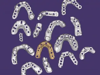 guide chirurgical implantaire (15 model).