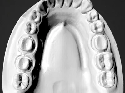 DENTAL MODEL for study