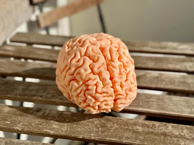 MRI Brain Scan