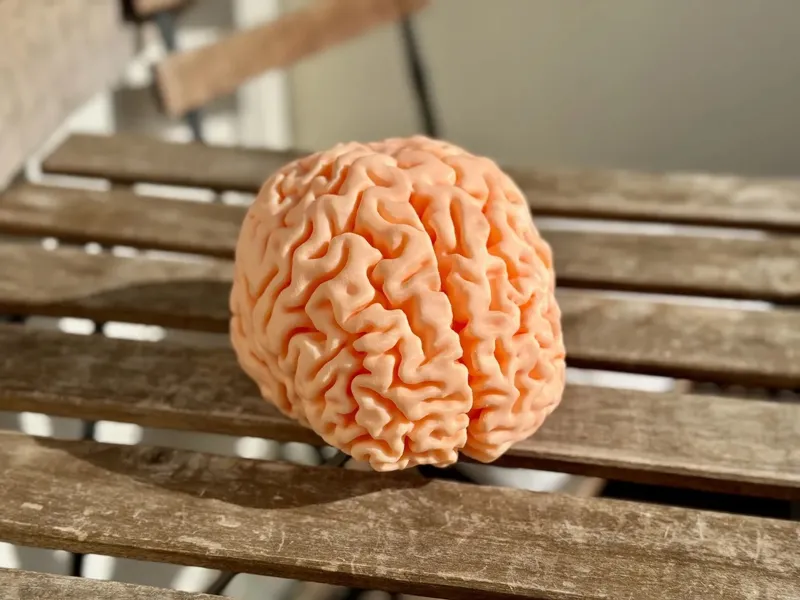 MRI Brain Scan