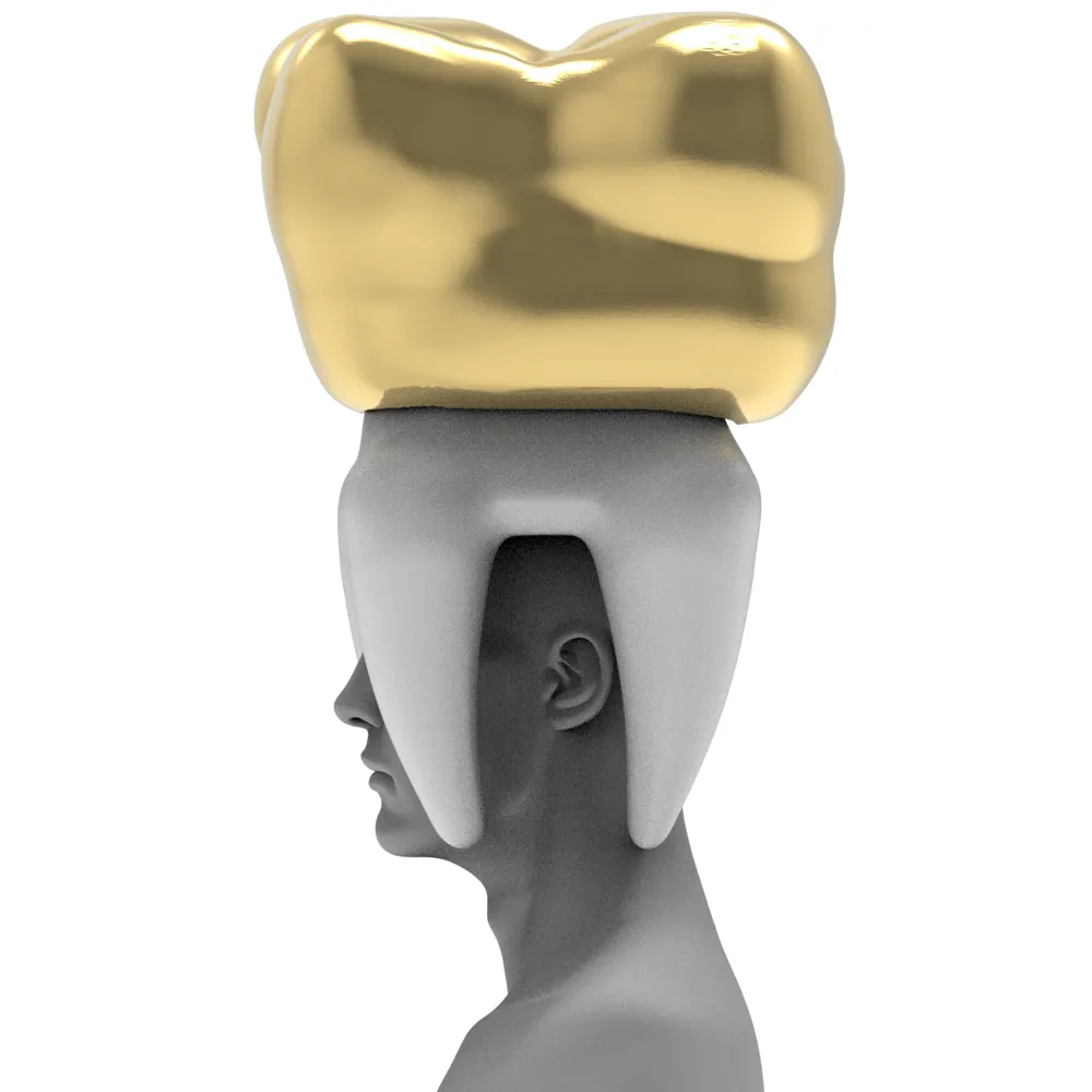 Gold (Dental) Crown by aldara3d MakerWorld: Download Free 3D Models
