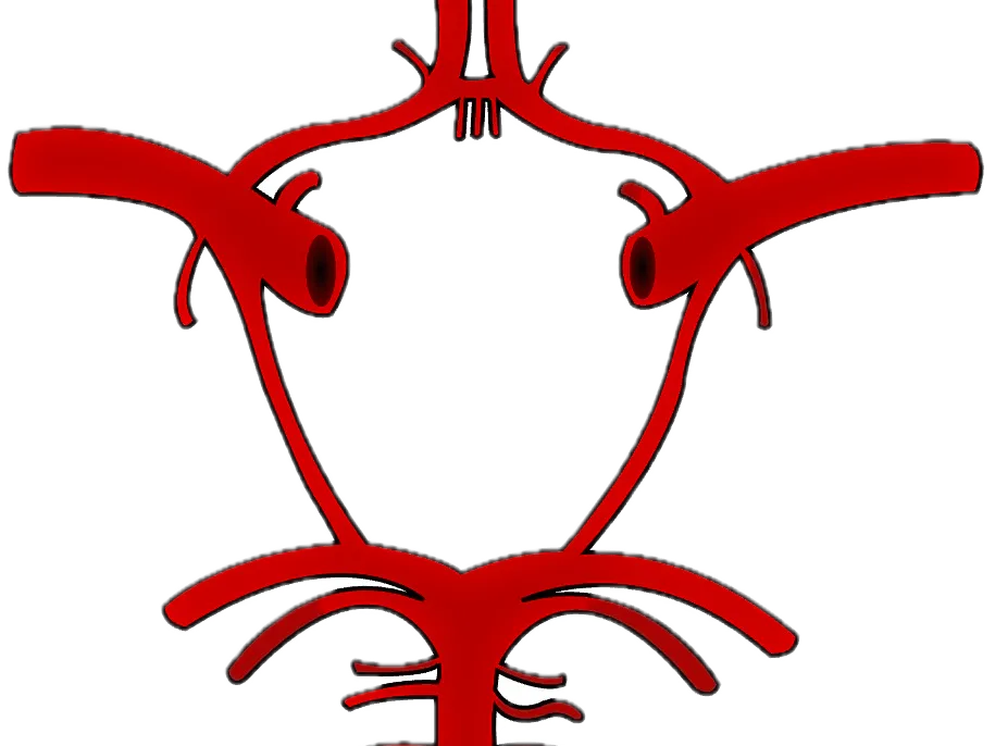 circle of willis - Free 3D Print Model - MakerWorld