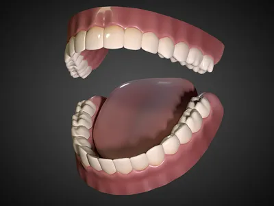 Denture