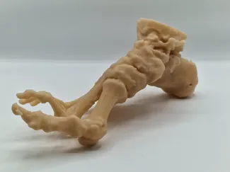 Human Foot Bone – 3D Model from MRI Scan