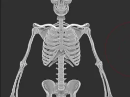 Thoracic Spine T12-T10