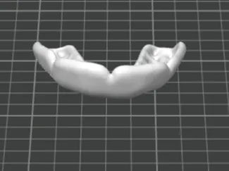 Mouthguard