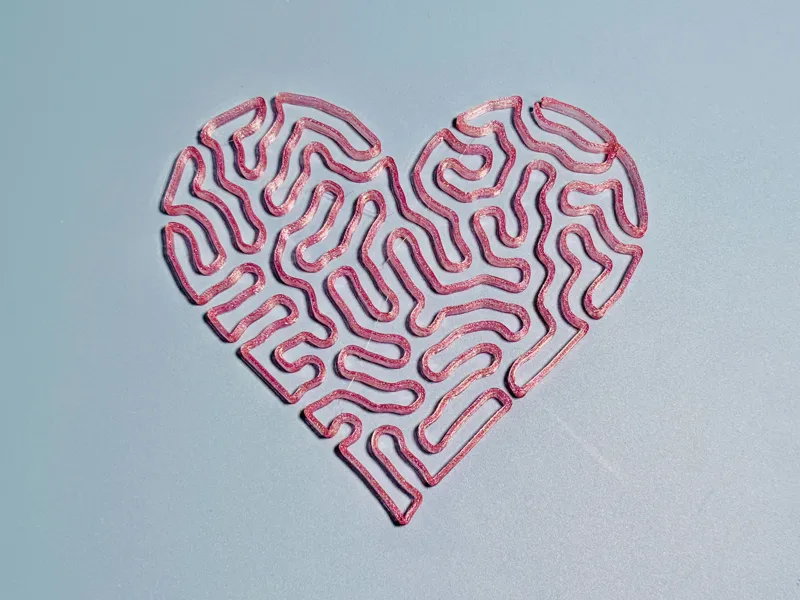 Heart with Differential Growth Pattern