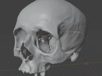 Human skull