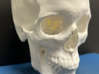 My Own Skull Created from CT Scan