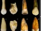 loose human teeth