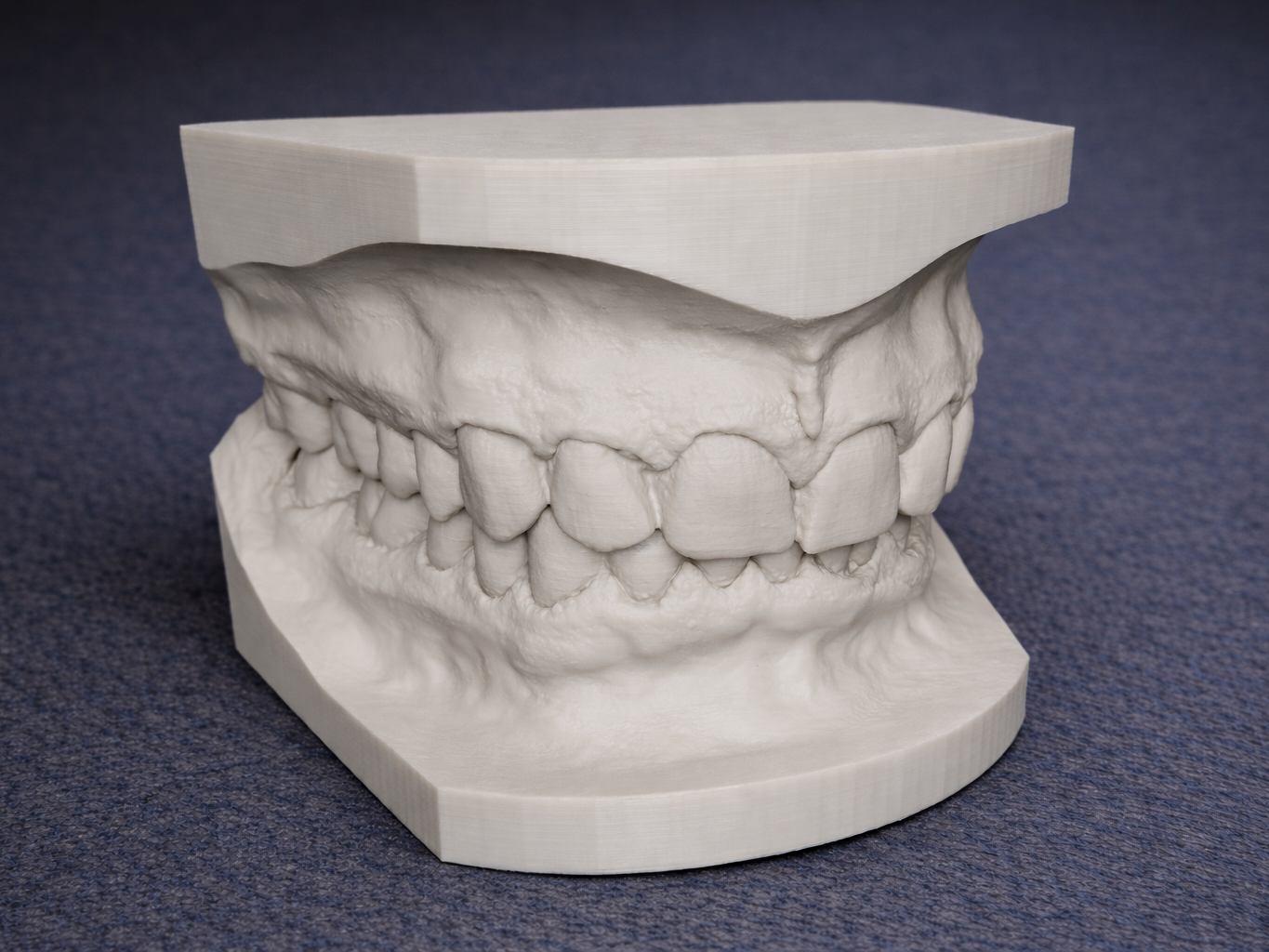 Dental Model Upper & Lower