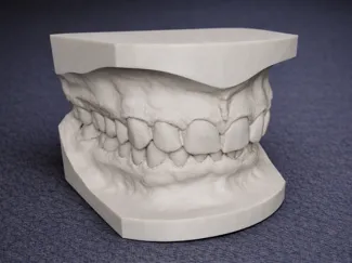 Dental Model Upper & Lower