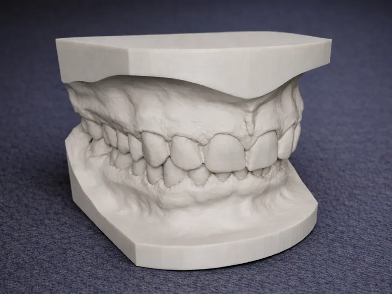 Dental Model Upper & Lower