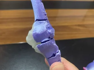 flexi knee
