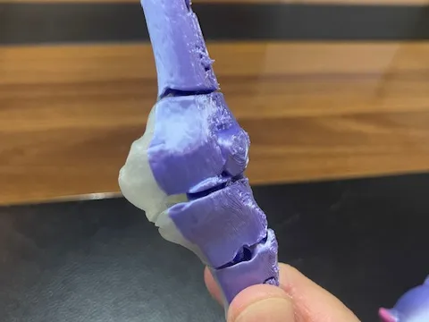 flexi knee 