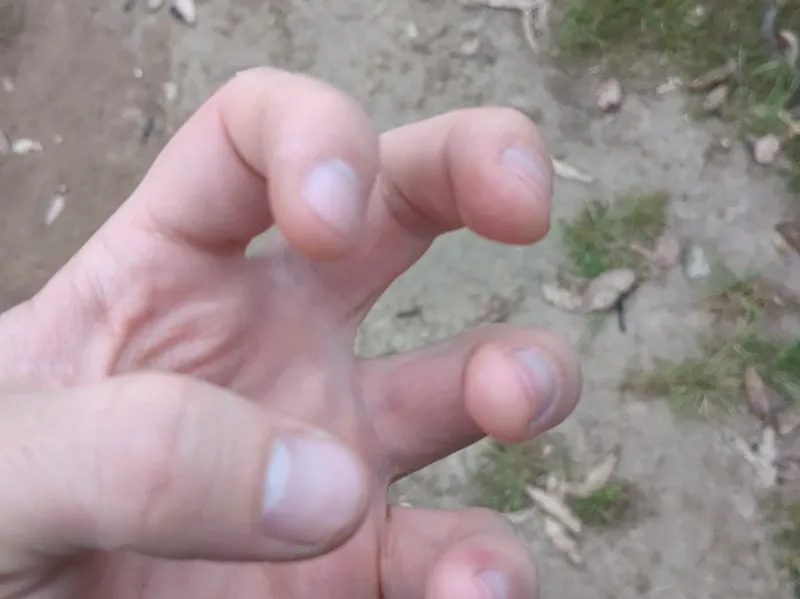 GeochaperPhoneBrace