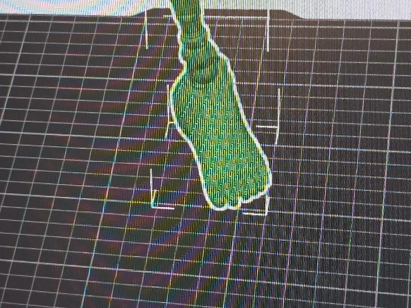 leg