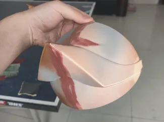 亚极陀肩甲