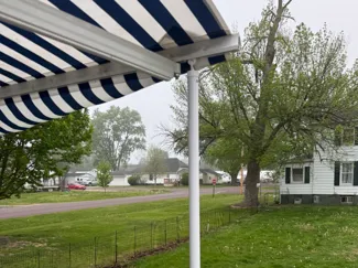 Retractable Awning Support Legs For Deck
