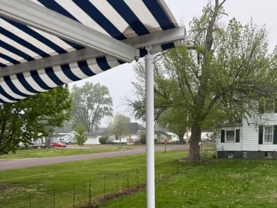 Retractable Awning Support Legs For Deck