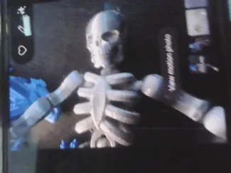 flexible skeleton