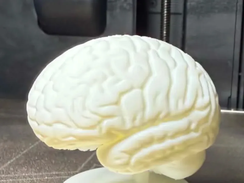 CEREBRO