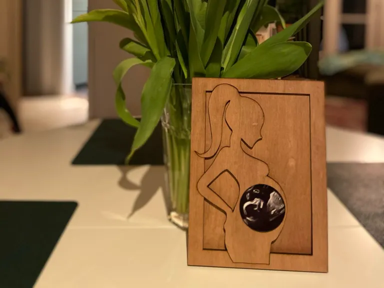 Pregnant lady - Ponytail - Ultrasound pictureframe