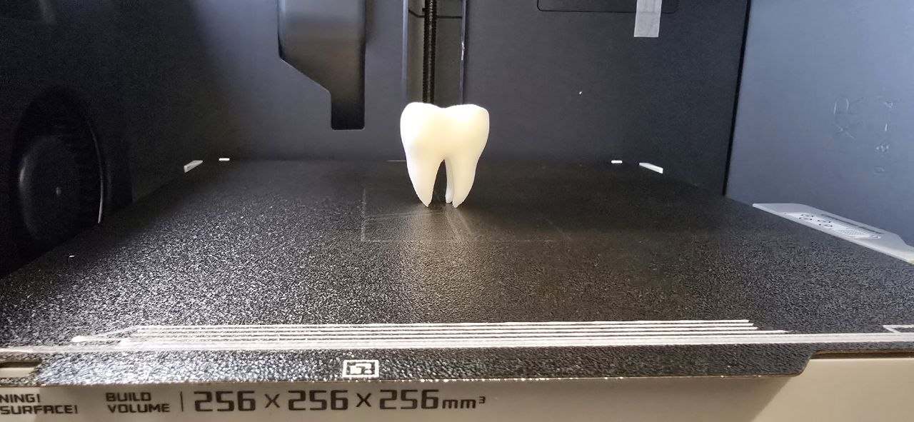 Miniatura 2 do modelo 3D Tooth