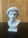 0.2mm layer, 2 walls, 7% infill