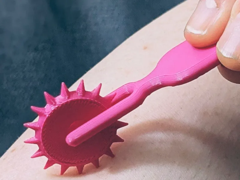 Wartenberg wheel