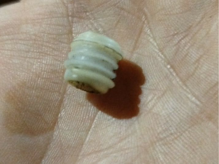 csiga menet