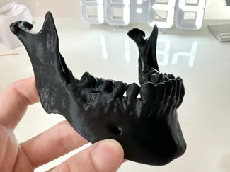 Mandible