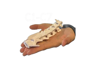 Teckel Cervicales Perro TAC - CT Scan C1-C7