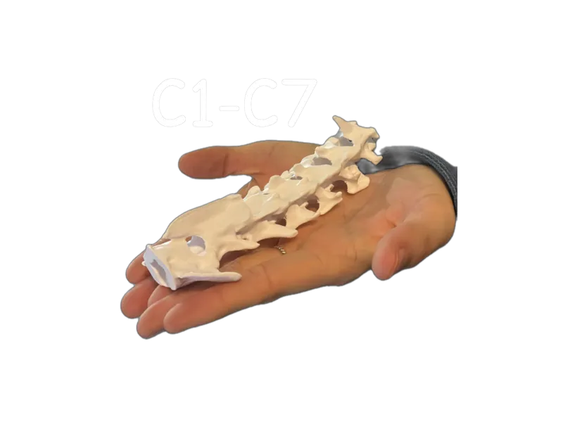 Teckel Cervicales Perro TAC - CT Scan C1-C7