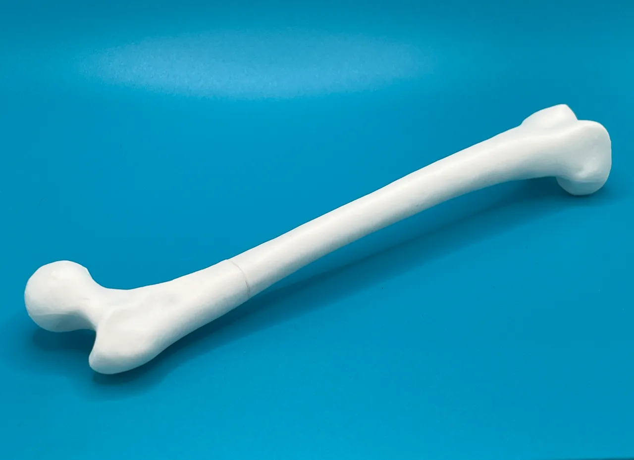 Femur (Thigh Bone) Pen view 2