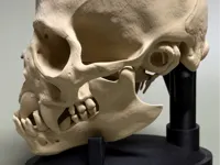0.2mm layer, 3 walls, 15% infill 100%