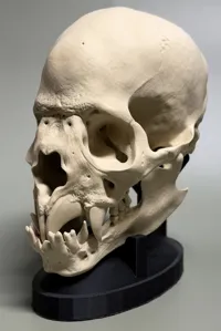 0.2mm layer, 3 walls, 15% infill 80%